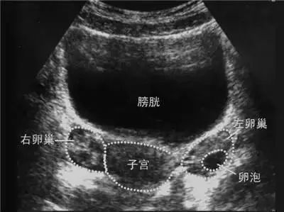 养精一个月能让怀孕事半功倍吗？