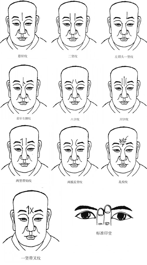 印堂有竖纹面相好不好？面相算命分析