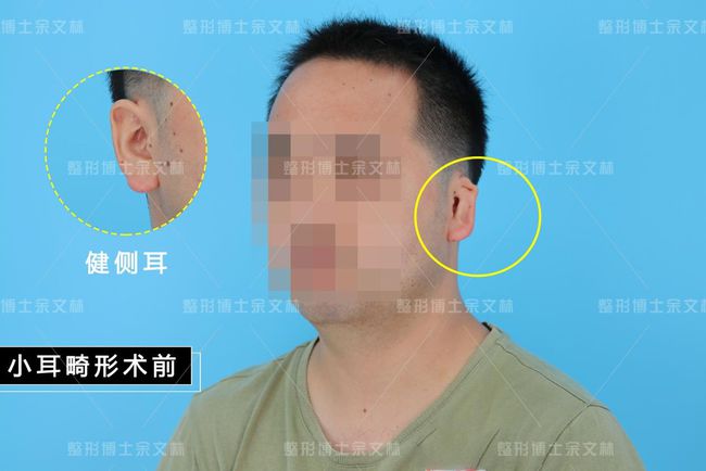 （李向东）耳垂面相看运势，怎么从耳垂看面相