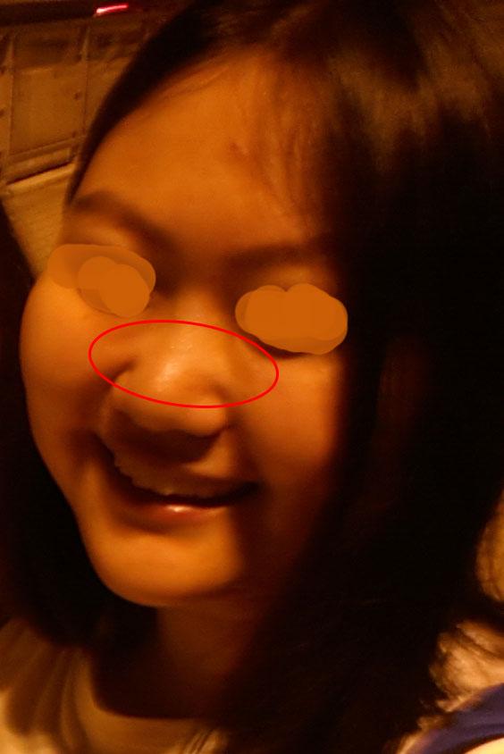 女人鼻子左边上有痣代表什么？面相图解告诉你